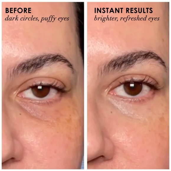 dERmELCT Eyelid & Dark Circle Corrector Professional Strength - Picture 13 of 15